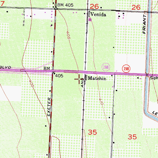Topographic Map of Matchin, CA