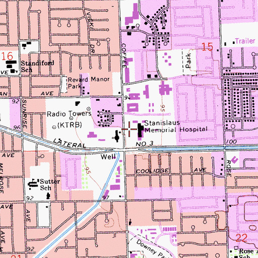 Topographic Map of Sutter Health Memorial Medical Center, CA