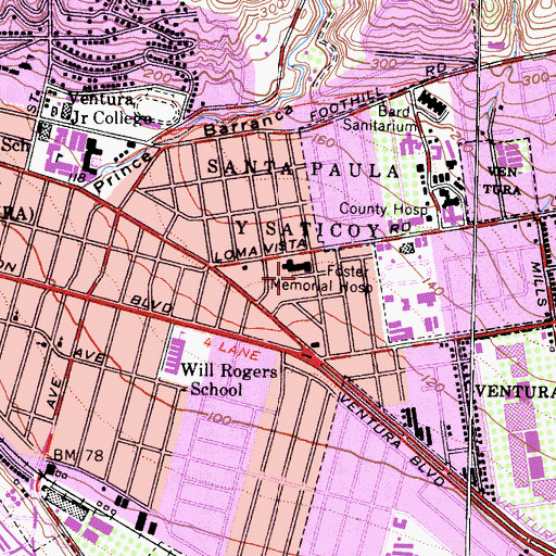 Topographic Map of Community Memorial Hospital San Buenaventura, CA