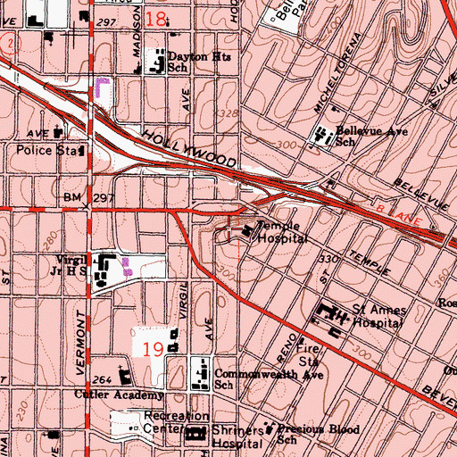 Topographic Map of Temple Community Hospital, CA