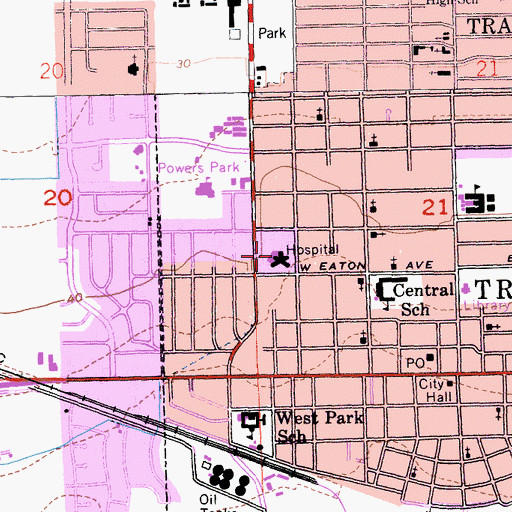 Topographic Map of Sutter Tracy Community Hospital, CA