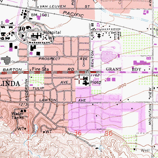 Topographic Map of Loma Linda Community Hospital, CA