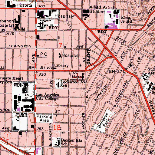 Topographic Map of Parkview Hospital, CA
