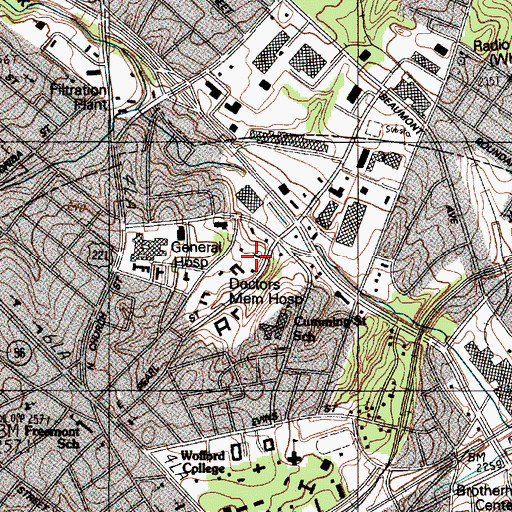Topographic Map of Spartanburg Surgery Center, SC