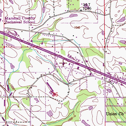 Topographic Map of Marshall Medical Professional Center, AL