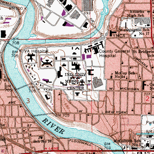 Topographic Map of Indiana University Medical Center, IN