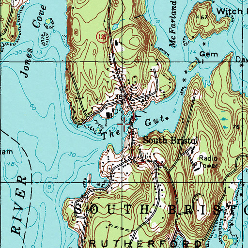Topographic Map of The Gut, ME